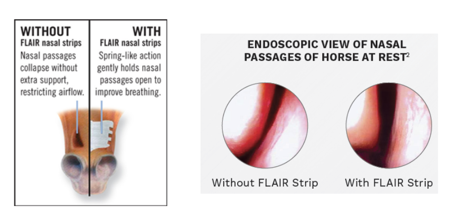 FLAIR Strips decrease airway resistance in nasal passage
